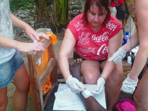 Volunteers conduct impromtu outreach wound care clinic in Ghana.